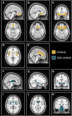 Dysfunctional Brain Networking among Autonomic Regulatory Structures in Temporal Lobe Epilepsy Patients at High Risk of Sudden Unexpected Death in Epilepsy